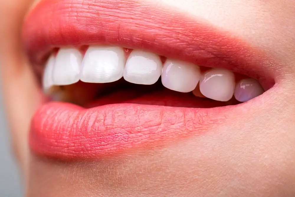 Blaqueamientos dentales en Chamartín - Zyra Dental